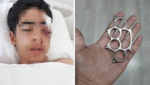 İstanbul Esenyurt’ta akran zorbalığı yine bir çocuğu hastanelik etti. 15