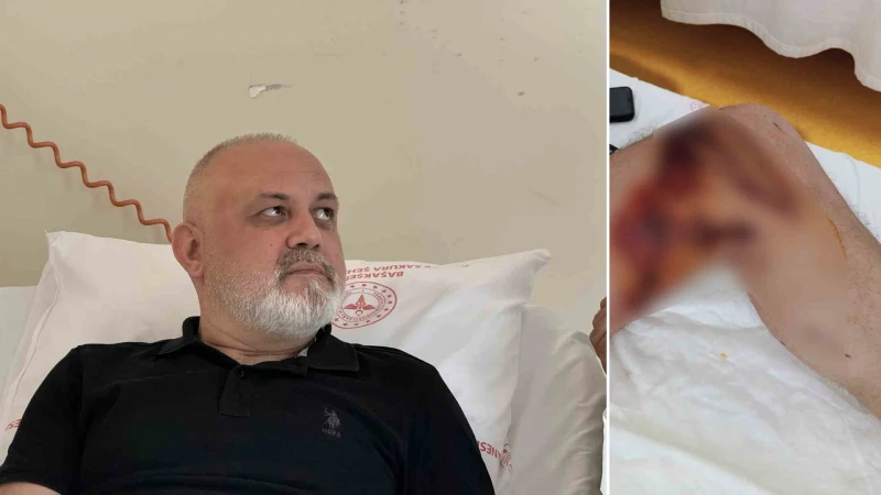 İstanbul’da 46 yaşındaki Ersan Akçil, iddiaya göre nalburdan aldığı lavabo